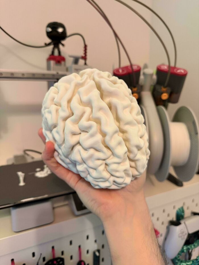 "Got An MRI And Printed My Own Brain"