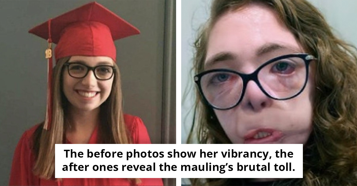 The Tragic Tale of Jacqueline Durand: A College Student's Vicious Dog Mauling