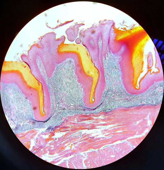 "We Had To Work With 25-Year-Old Samples, And If I Am Correct, This Is A Tongue. I Find It Insane That Prepared Samples This Old Still Look This Good Under A Microscope!"