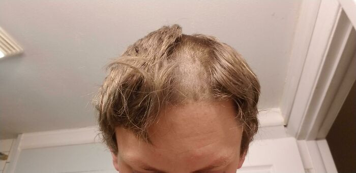"After Fixing My Hair Trimmer, I Forgot To Put The Depth Guard On"