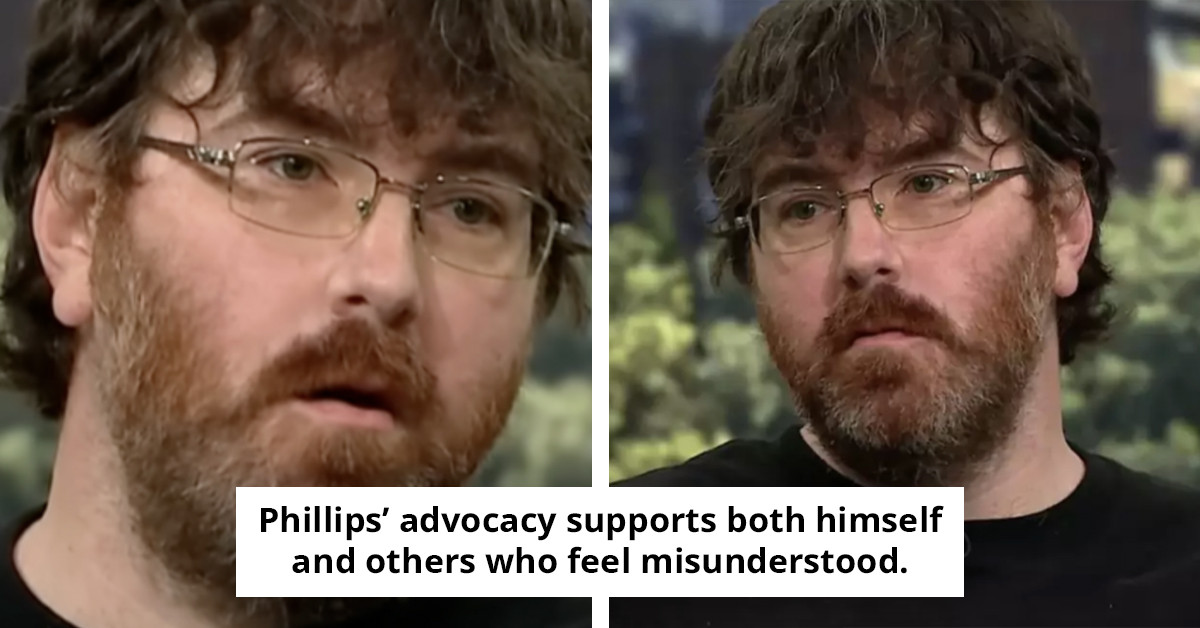 Challenges Faced Daily by Man with 'Smallest Penis in the World'