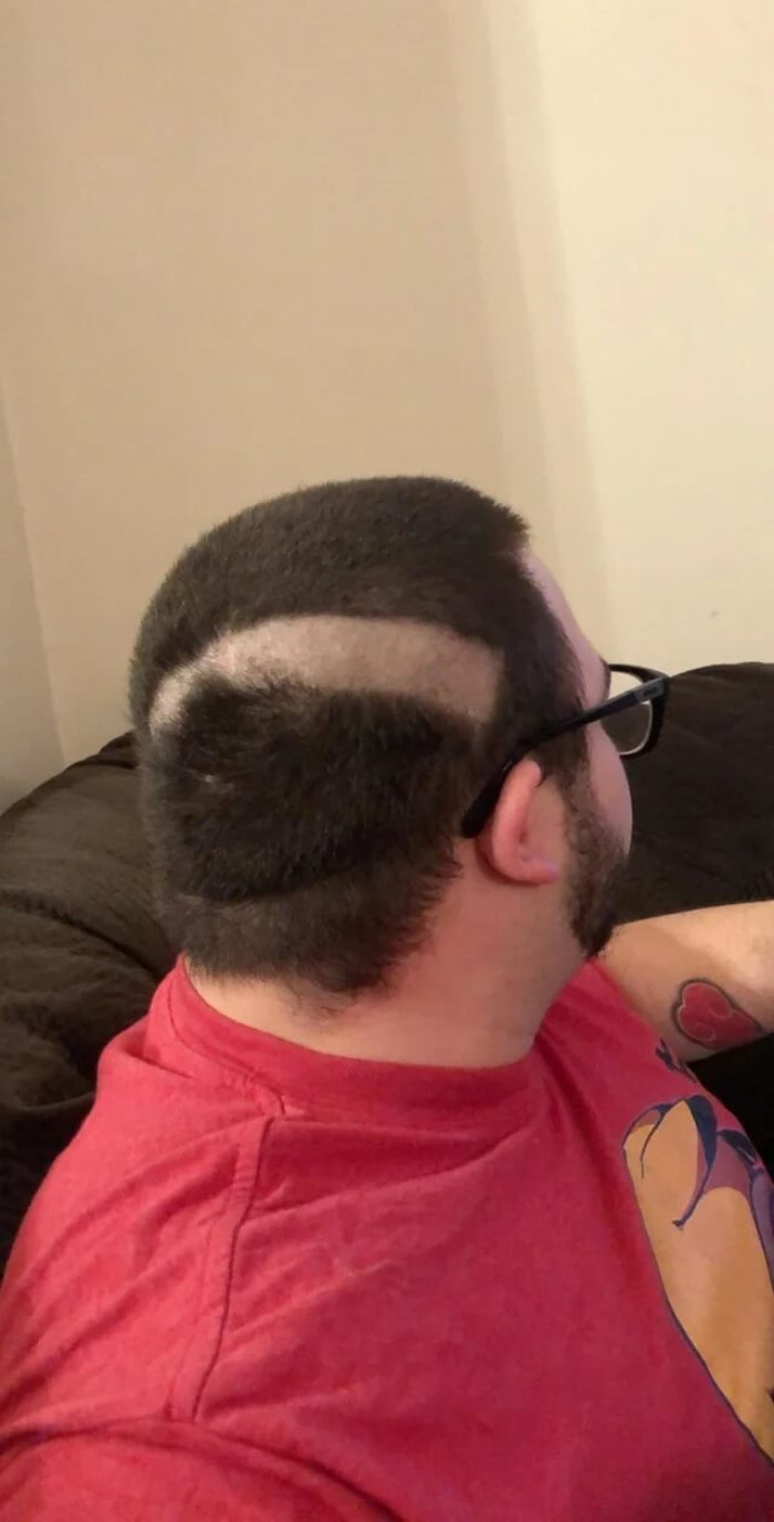 20. The razor edge broke off in my hair and left me with the following.