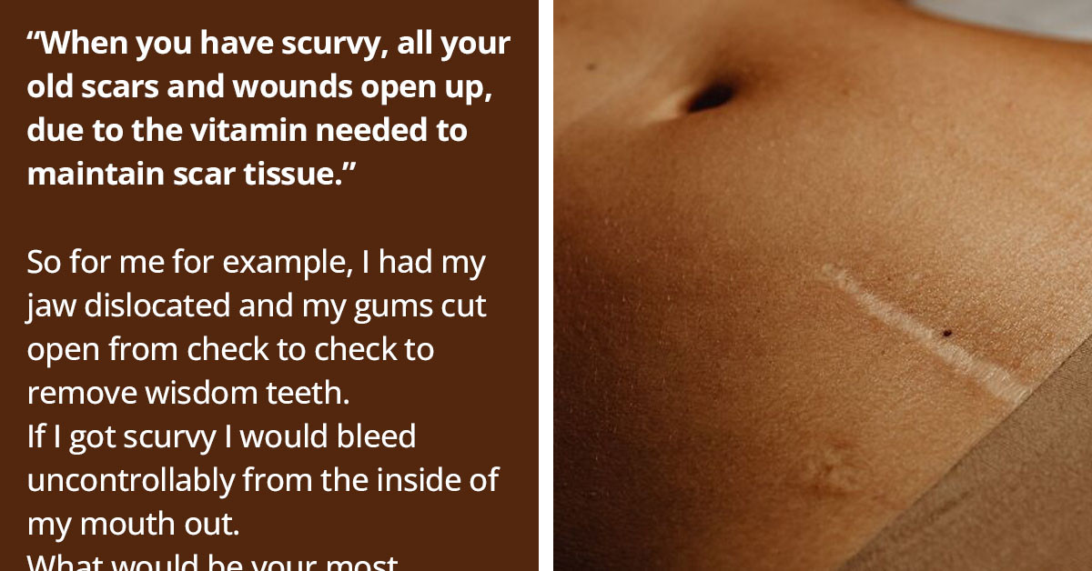 Horrifying And Scary Facts About Life And The World That Shouldn't Normally Be True, But Unfortunately Are