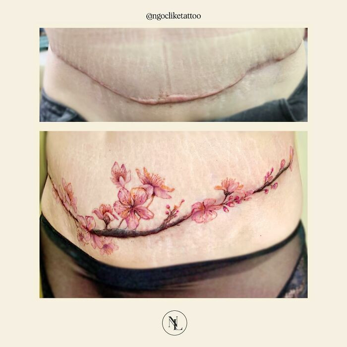 44. It's all flowers