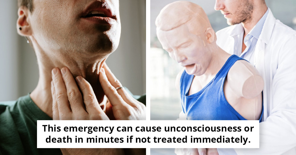 Physician shares 3 essential steps to potentially save your life in a choking emergency when you're alone.