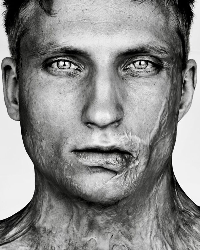 “Axel Schylström” - Scars