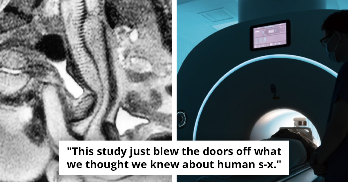 Researchers uncover a baffling mystery following a couple's MRI scan to reveal the truth about intimacy