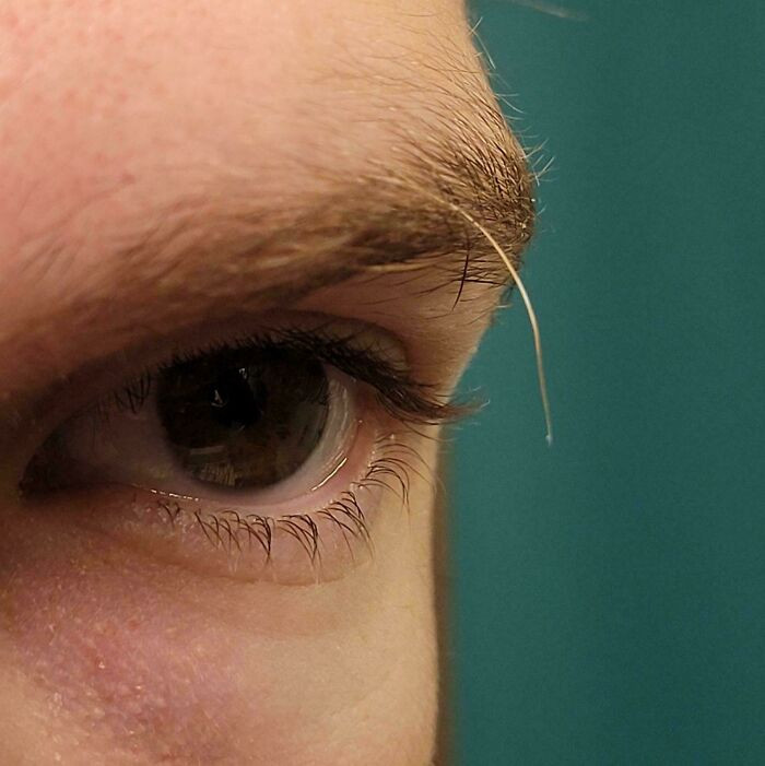 "I Have 1 Really Long Eyebrow Hair That Always Grows Back"