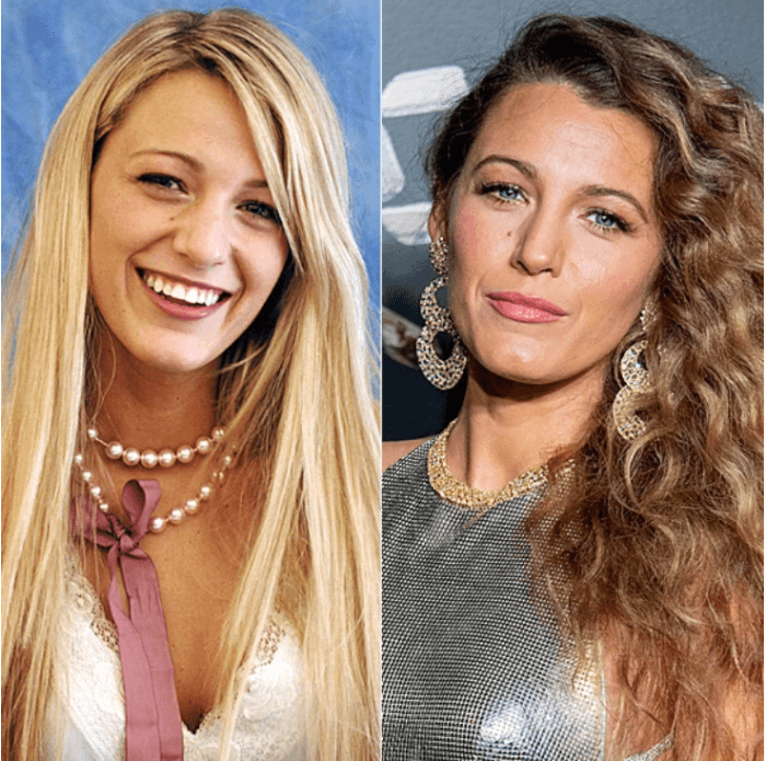 7. Blake Lively has consistently denied having surgery; however, it appears that her nose has been nipped and tucked.