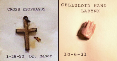 Bizarre Objects Swallowed By Kids Are On Display At The Boston Children's Hospital