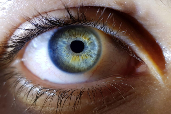 Blue Eyes Are Rare But Found Around the World