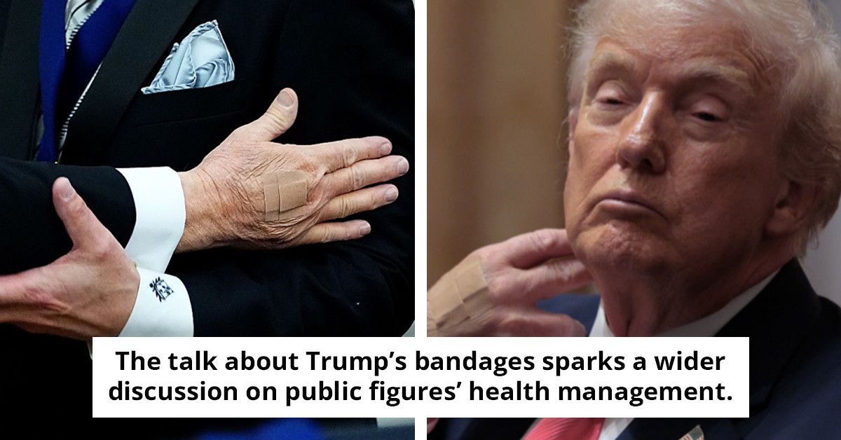White House unveils unexpected explanation for Trump's hand bandages