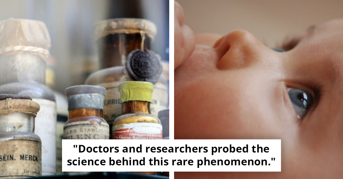 Baby Girl Born with Second Mouth: A Medical Marvel of 2020