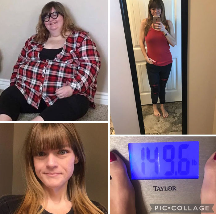 "The Ones Seen In /R/Progresspics And /R/Loseit Are Super Inspiring, Especially People Who Have Lost Over 200-300 Lbs"