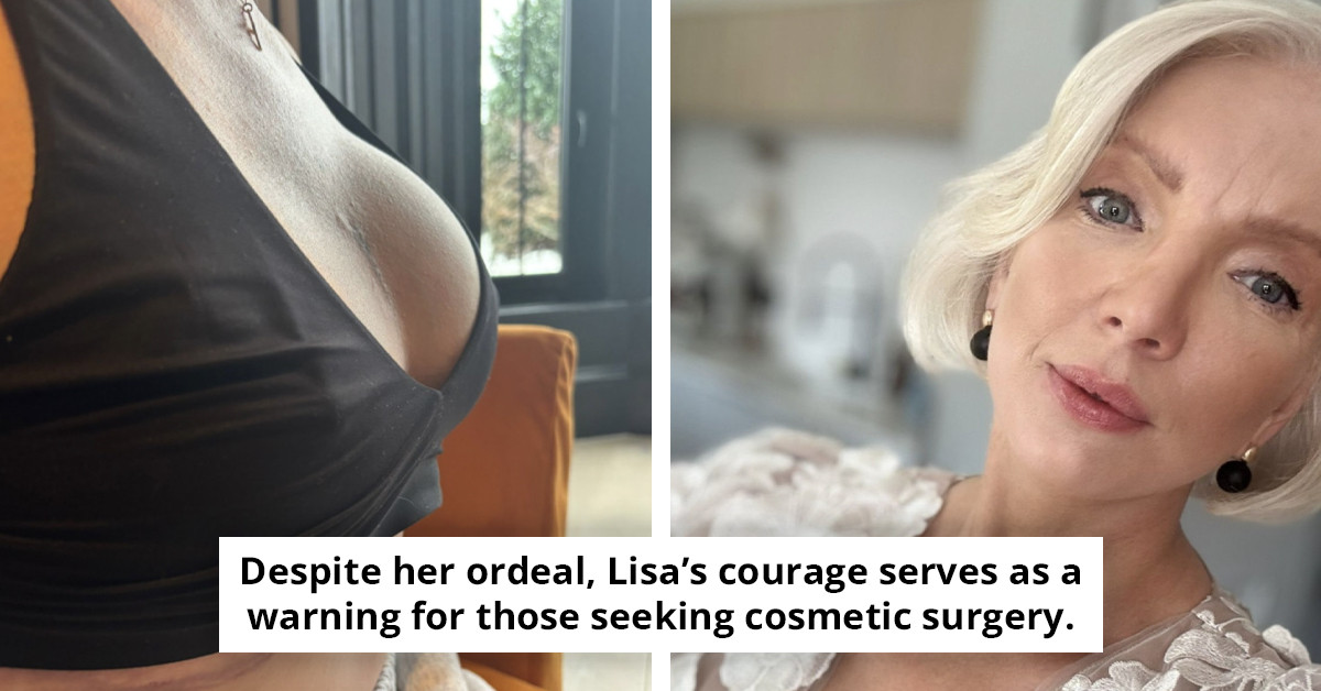 Woman who narrowly escaped death shares how she sensed trouble following $20k breast enhancement as green fluid leaked