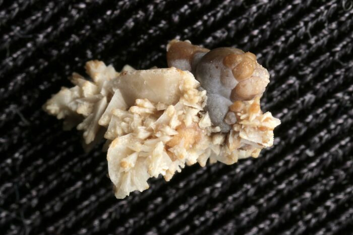 "Here's A Kidney Stone That I Passed A While Back"