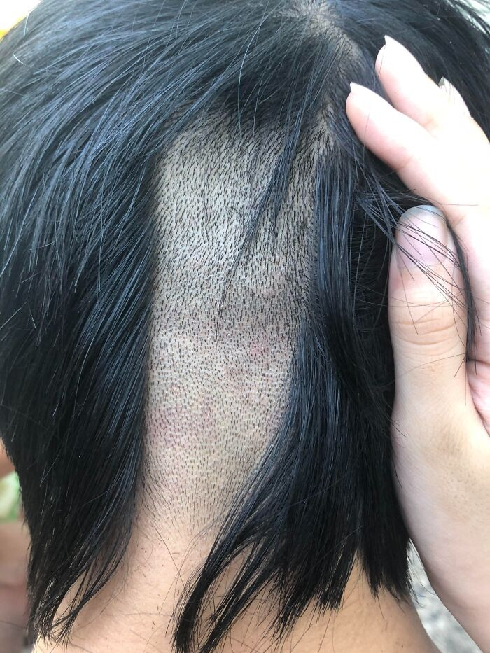 "My Mom Made A Mistake While Cutting My Hair"