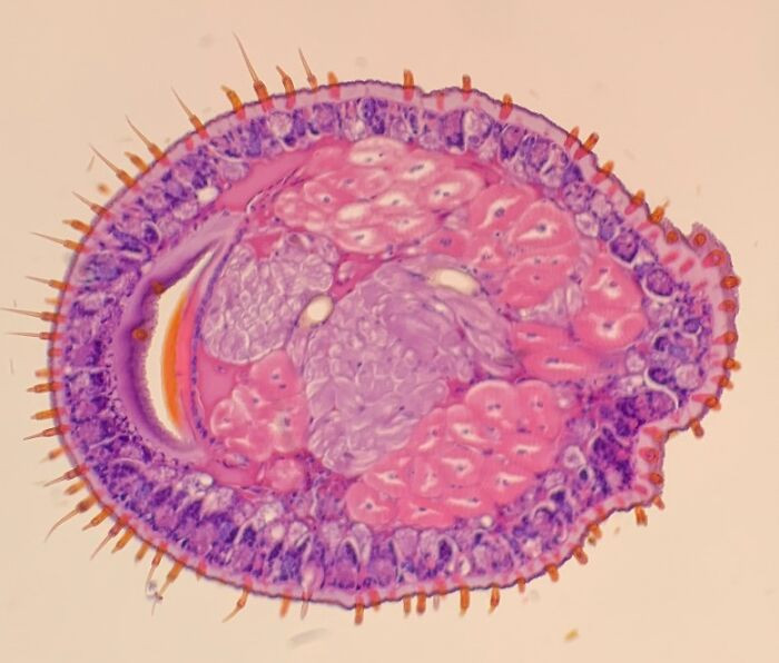 "Microscopic Cross-Section Of The Leg Of A Red Centipede"