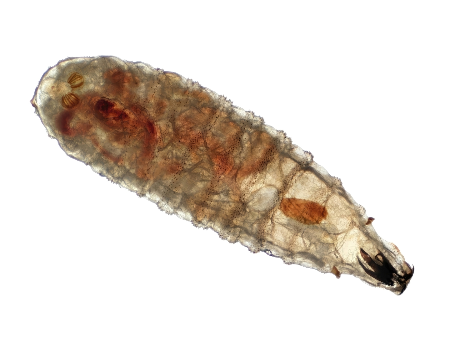 First US case of travel-related New World screwworm confirmed in Maryland patient after trip to El Salvador