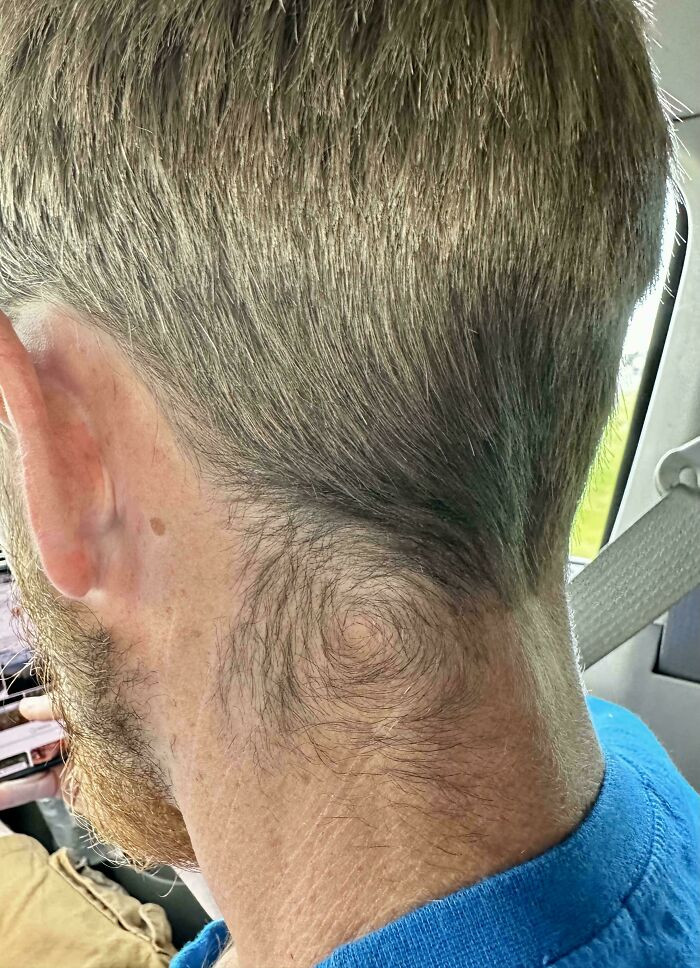 "My Boyfriend Has These Swirls On Both Sides Of His Neck"