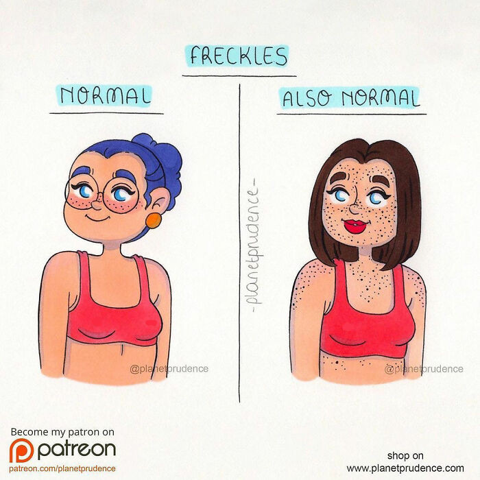 11. Having Freckles Is Totally Normal
