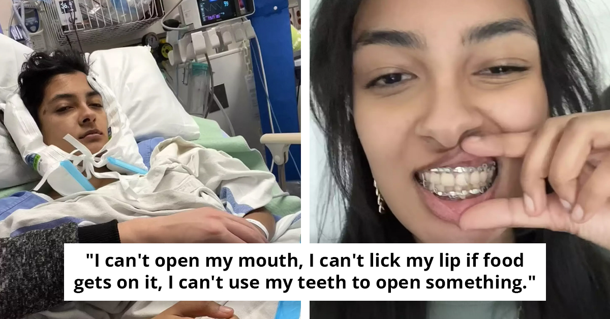 Student Ends Up In Hospital After Ironically Breaking Her Jaw On A Jawbreaker Candy