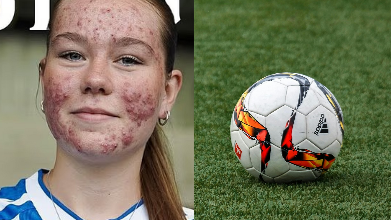 A 16-year-old football player who was recently targeted with cruel online comments about her skin has delivered the perfect response, not with words, but with her talent on the pitch.