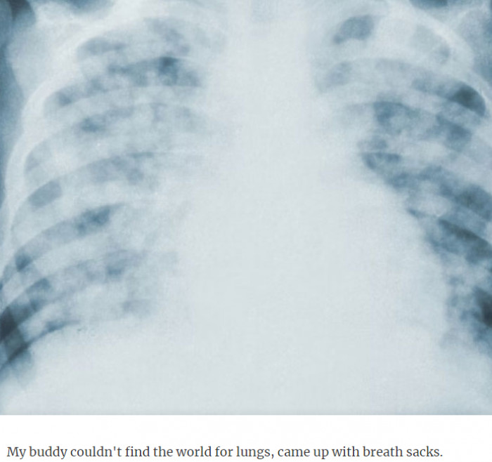 26. Well, let me just drop this here