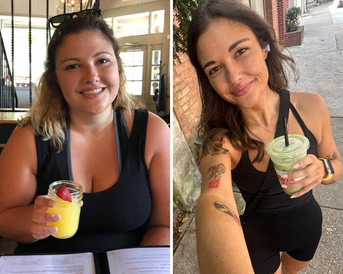"138 Lbs Down. Skin Surgery In Just 2 Weeks"