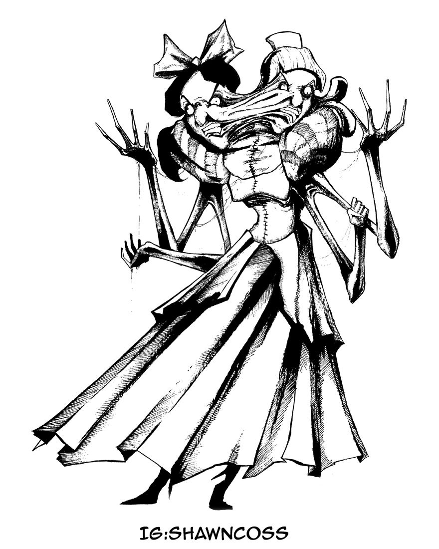 6. The Cinderella Conjoined Twins