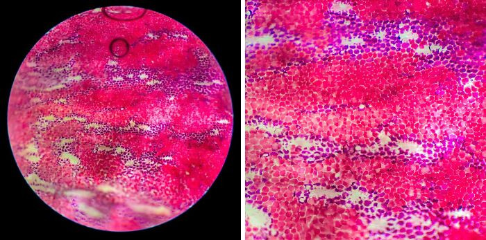 "I Took Some Pictures Of A Rose Under The Microscope"