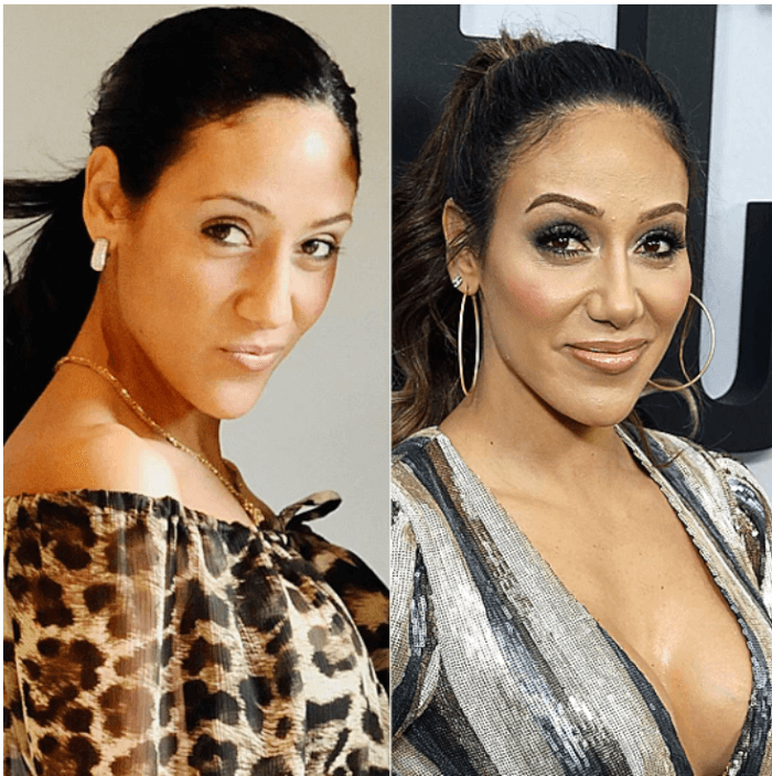 4. Melissa Gorga discussed her nose job after being criticized by Jacqueline Laurita.