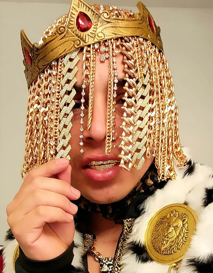 6. Dan Sur Has Surgically Implanted Gold Chains to Replace His Hair