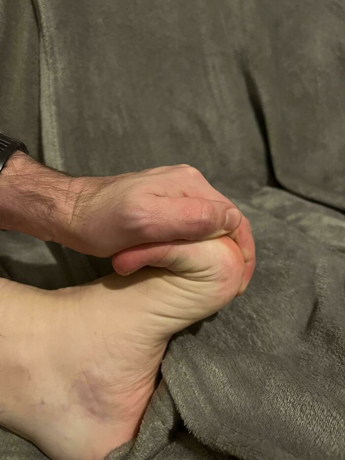 "I Can Bend My Toes Back To My Foot"