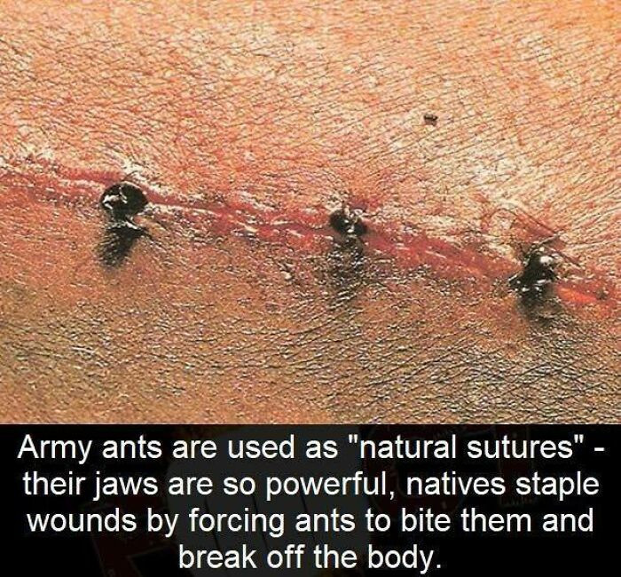 22. Interesting Trivia: