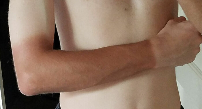 "Got A New Job Where I Have To Wear A Uniform And Gloves While Working Outside; Now I Look Like This"