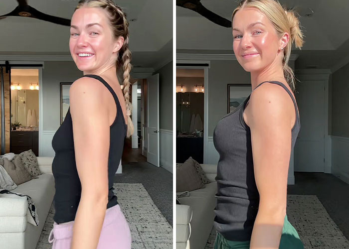 Lindsay Arnold - Breast augmentation