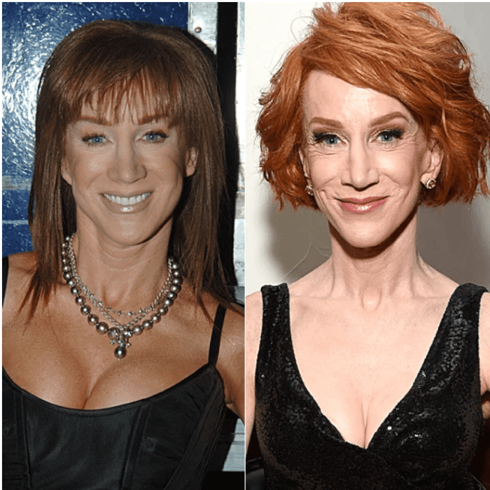 6. Kathy Griffin had her nose altered because she thought it was a bit large, but she felt the results were the same.
