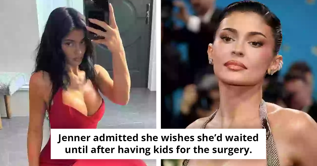 Kylie Jenner’s Breast Surgeon Speaks Out After She Reveals Procedure Details