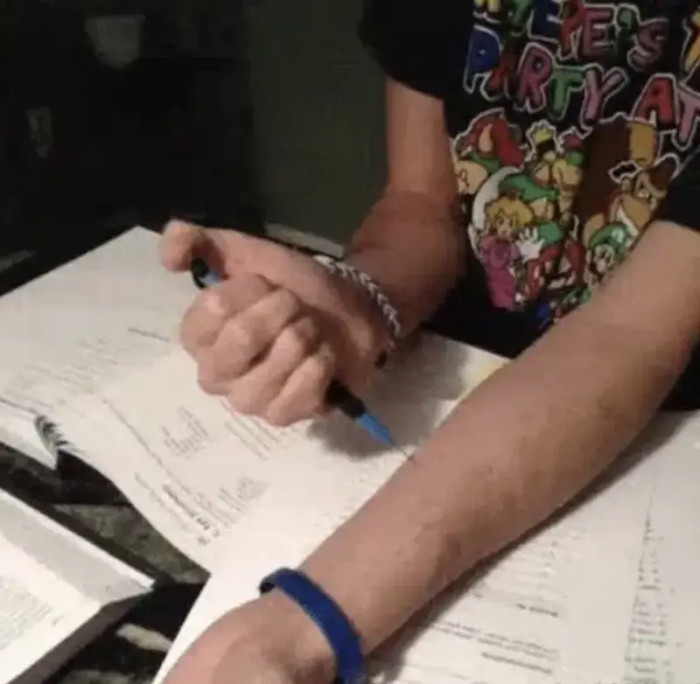 27. When you thought stabbing yourself with a mechanical pencil made you cool